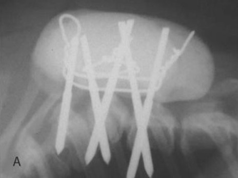 ili me uetiko spiroma