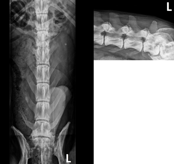 oeuogonies aktinografies diskospondylitida