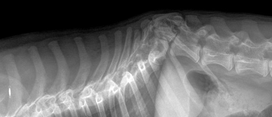 plagia aktinograf;ia hmispondilos