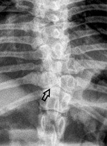 aktinografia petalouda