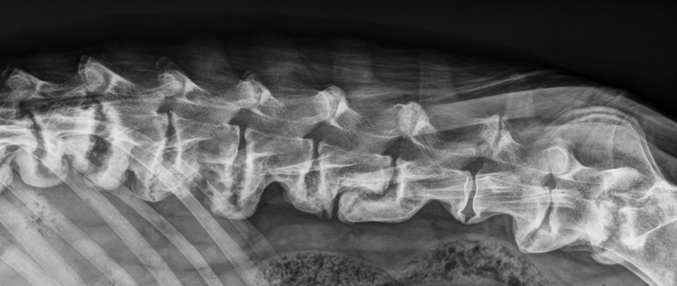 aktinografia diskospondylitida