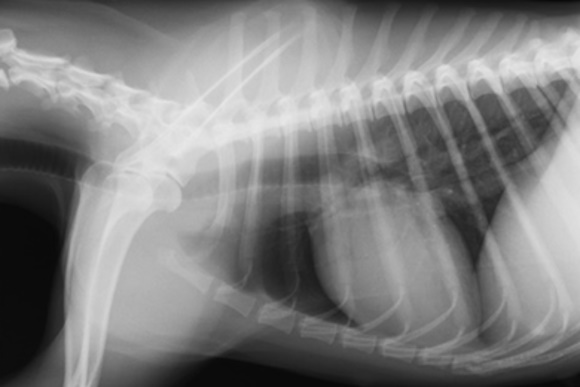 aktinografia megaisofagos