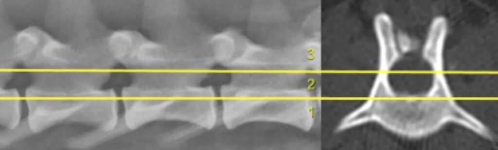 diamerisma gia katagmata