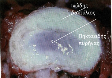tipikos mesospondilios diskos