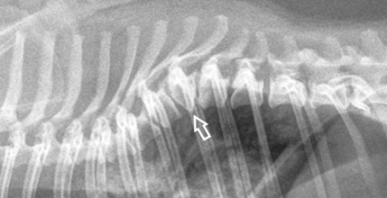 imispondilos aktinografia