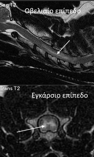 magnitiki se inoxodrino