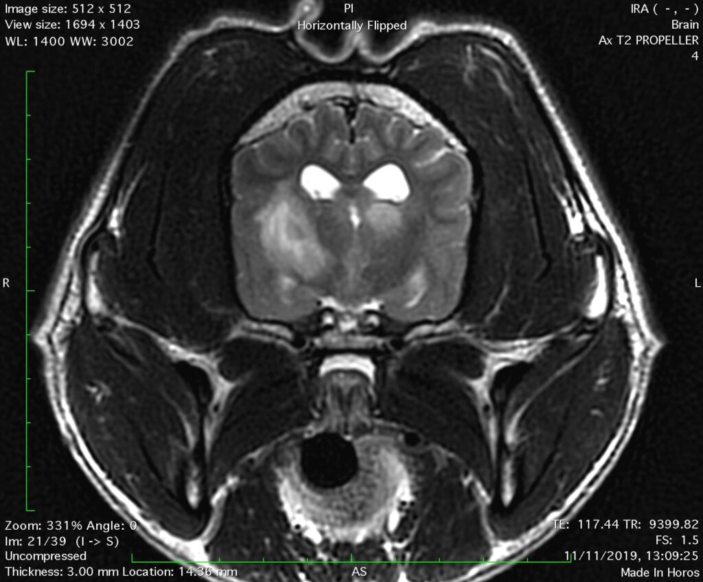 magnitiki minigoecephalitida