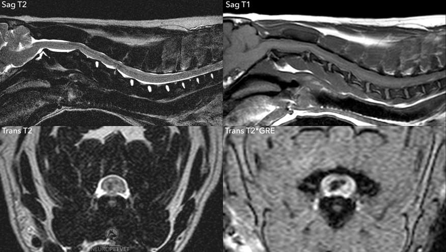 sindromo kentrikoy solina
