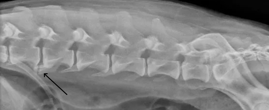 aktinografia paramorfotiki sondylosis
