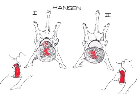 diskokili ena kai dyo
