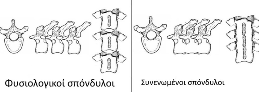 synenomenoi spondiloi