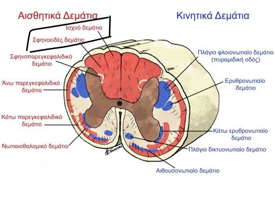 sxhmatiki parastasi se notieo mielo