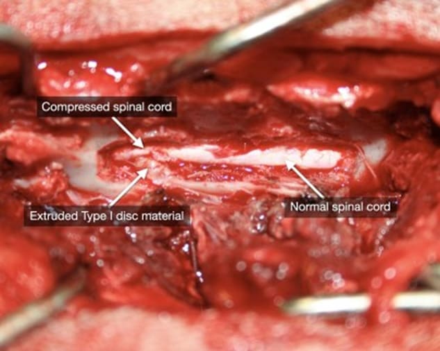 xiroyrgio se diskokili