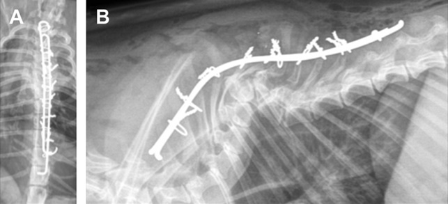 χιρουργιο ημισπονδυλοσ