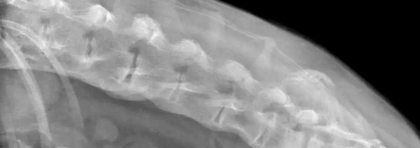 aktinografia yperostosi